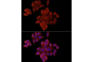 Immunofluorescence analysis of HeLa cells using OP antibody (ABIN6129426, ABIN6145031, ABIN6145032 and ABIN6225150) at dilution of 1:100 (40x lens). (OPA1 Antikörper  (AA 661-960))