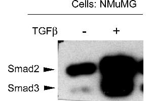 NMuMG mouse mammary epithelial cells were probed for the activation of Smad3 by detecting phosphorylation of threonine 179.