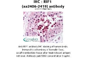 Image no. 2 for anti-RAP1 Interacting Factor Homolog (RIF1) (AA 2406-2419) antibody (ABIN1738875)