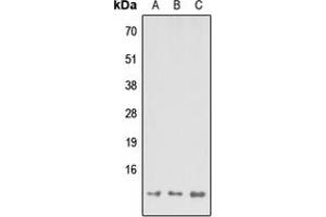 Western blot analysis of MP68 expression in HEK293T (A), Raw264. (C14orf2 Antikörper  (Center))