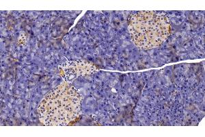Detection of CHIT1 in Mouse Pancreas Tissue using Polyclonal Antibody to Chitinase 1 (CHIT1) (Chitotriosidase 1 Antikörper  (AA 210-464))