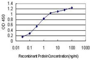 Detection limit for recombinant GST tagged CYP46A1 is approximately 0. (CYP46A1 Antikörper  (AA 201-300))