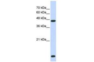 Image no. 1 for anti-Histone Deacetylase 8 (HDAC8) (N-Term) antibody (ABIN6742492) (HDAC8 Antikörper  (N-Term))