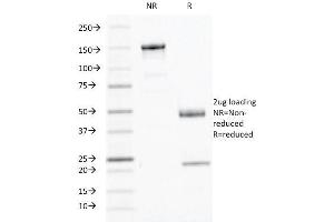 SDS-PAGE Analysis Purified Interferon gamma Mouse Monoclonal Antibody (IFNG/466). (Interferon gamma Antikörper)