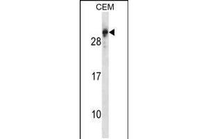 Western blot analysis in CEM cell line lysates (35ug/lane). (RGS5 Antikörper  (N-Term))