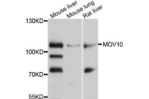 Western blot analysis of extracts of various cell lines, using MOV10 antibody (ABIN1873740) at 1:1000 dilution. (MOV10 Antikörper)