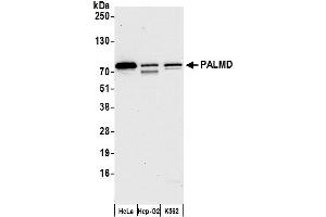 anti-Palmdelphin (PALMD) (AA 325-375) antibody