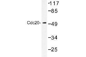 Image no. 1 for anti-Cell Division Cycle 20 Homolog (S. Cerevisiae) (CDC20) antibody (ABIN272282) (CDC20 Antikörper)