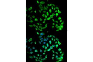 Immunofluorescence analysis of U20S cell using GPS1 antibody.