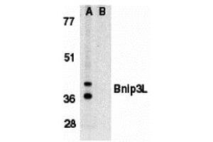 Western Blotting (WB) image for anti-BCL2/adenovirus E1B 19kDa Interacting Protein 3-Like (BNIP3L) antibody (ABIN1031701) (BNIP3L/NIX Antikörper)
