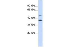 Image no. 1 for anti-Methylmalonic Aciduria (Cobalamin Deficiency) CblD Type, with Homocystinuria (MMADHC) (AA 216-265) antibody (ABIN6741309) (MMADHC Antikörper  (AA 216-265))