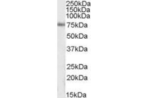 Image no. 1 for anti-Inositol-Trisphosphate 3-Kinase C (ITPKC) (AA 105-119) antibody (ABIN490480) (ITPKC Antikörper  (AA 105-119))
