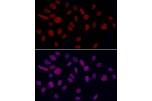 Immunofluorescence analysis of U2OS cells using YE Rabbit pAb (ABIN6130808, ABIN6150331, ABIN6150332 and ABIN6221925) at dilution of 1:50 (40x lens). (GAS41 Antikörper  (AA 1-227))