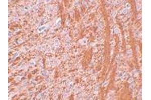 Immunohistochemistry (IHC) image for anti-Jumonji Domain Containing 6 (JMJD6) (N-Term) antibody (ABIN1031427) (JMJD6 Antikörper  (N-Term))