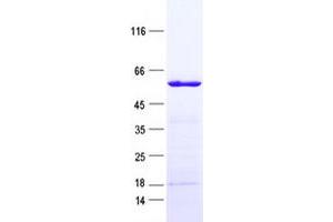 Validation with Western Blot