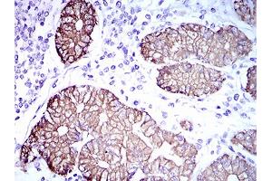 Immunohistochemical analysis of paraffin-embedded stomach tissues using CK5 mouse mAb with DAB staining. (Cytokeratin 5 Antikörper  (AA 316-590))