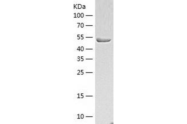 KRT8 Protein (AA 1-483) (His tag)