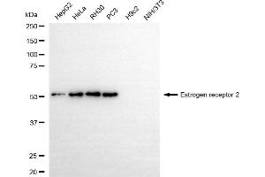 Western blotting analysis using estrogen receptor 2 antibody (ABIN7798494). (Rekombinanter ESR2 Antikörper)