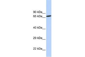 WB Suggested Anti-ZNF571 Antibody Titration:  0. (ZNF571 Antikörper  (N-Term))