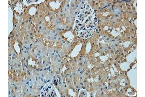 Immunohistochemistry (Paraffin-embedded Sections) (IHC (p)) image for anti-Matrix Metallopeptidase 1 (Interstitial Collagenase) (MMP1) (AA 20-280) antibody (ABIN3021680)
