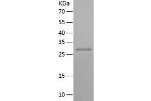 PCDHGC4 Protein (AA 380-642) (His tag)