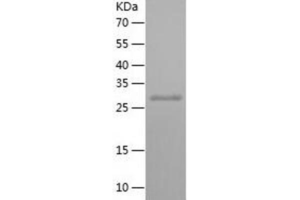 PCDHGC4 Protein (AA 380-642) (His tag)