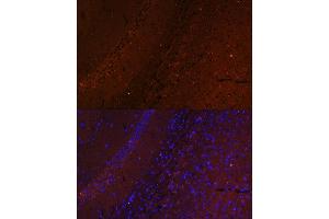 Immunofluorescence analysis of mouse brain using RUSC1 antibody (ABIN7270114) at dilution of 1:100. (RUSC1 Antikörper  (AA 1-320))