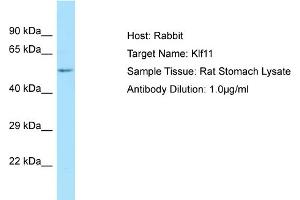 WB Suggested Anti-Klf11 Antibody   Titration: 1.