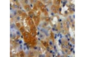 Used in DAB staining on fromalin fixed paraffin-embedded Kidney tissue (TGFB3 Antikörper  (AA 274-372))