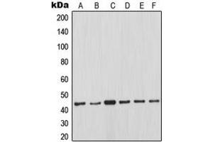 Western blot analysis of MCL1 expression in Ramos (A), JAR (B), K562 (C), Jurkat (D), Raji (E), HeLa (F) whole cell lysates. (MCL-1 Antikörper  (Center))