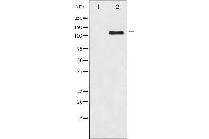 Western blot analysis of JAK2 expression in K562 whole cell lysates,The lane on the left is treated with the antigen-specific peptide. (JAK2 Antikörper  (N-Term))