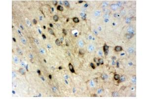 IHC analysis of Stathmin 1 using anti-Stathmin 1 antibody (ABIN3043301).