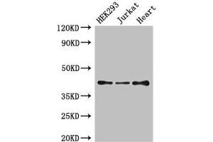 Western Blot Positive WB detected in: HEK293 whole cell lysate, Jurkat whole cell lysate, Mouse heart tissue All lanes: S1PR5 antibody at 4 μg/mL Secondary Goat polyclonal to rabbit IgG at 1/50000 dilution Predicted band size: 42, 33 kDa Observed band size: 42 kDa (S1PR5 Antikörper  (AA 309-398))