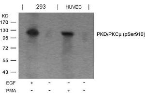 Western blot analysis of extracts from EGF-treated 293 and PMA-treated HUVEC cells using PKD/PKCm(Phospho-Ser910) Antibody. (PKC mu Antikörper  (pSer910))