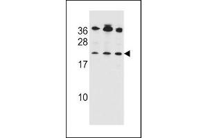 Bak antibody western blot analysis in 1) Jurkat, 2) MDA-MB453 and 3) 293 lysate (BAK1 Antikörper  (AA 56-91))