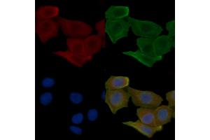 ABIN6257995 and ABIN6275571 staining Hela cells(30 min of UV treatment) by IF/ICC. (SIRPB1 Antikörper  (Internal Region))