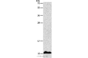 Western blot analysis of Human fetal liver tissue, using APOC1 Polyclonal Antibody at dilution of 1:500 (APOC1 Antikörper)