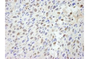 Immunohistochemistry (IHC) image for anti-Mediator Complex Subunit 12 (MED12) (C-Term) antibody (ABIN7448660) (MED12 Antikörper  (C-Term))