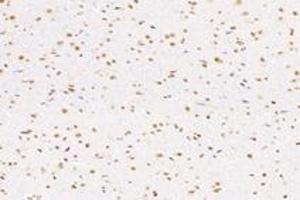 Immunohistochemistry (Paraffin-embedded Sections) (IHC (p)) image for anti-Nucleoporin 133kDa (NUP133) antibody (ABIN7074909)