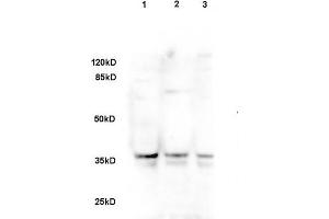 Sheep fat cell lysate 30ug, probed with Rabbit Anti-DLK1/DLL1 Polyclonal Antibody (ABIN740055) at 1:200 overnight in 4 °C. (DLK1 Antikörper  (AA 251-350))