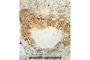 Immunohistochemistry (IHC) image for anti-Desmocollin 1 (DSC1) antibody (ABIN3003859) (Desmocollin 1 Antikörper)