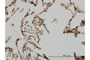 Immunoperoxidase of monoclonal antibody to UBE3A on formalin-fixed paraffin-embedded human lung. (ube3a Antikörper  (AA 51-150))