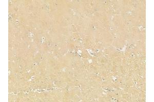 ABIN6259339 and ABIN6275439 at 1/100 staining human normal gastric tissue by IHC-P.