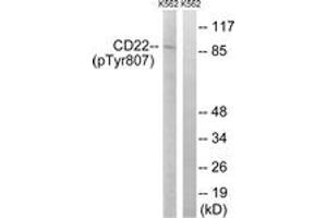 Western blot analysis of extracts from K562 cells treated with Na3VO4 0. (CD22 Antikörper  (pTyr807))