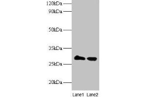 Western blot All lanes: TPMT antibody at 2 μg/mL Lane 1: EC109 whole cell lysate Lane 2: 293T whole cell lysate Secondary Goat polyclonal to rabbit IgG at 1/15000 dilution Predicted band size: 29 kDa Observed band size: 29 kDa