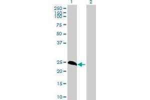 Western Blot analysis of METT5D1 expression in transfected 293T cell line by METT5D1 MaxPab polyclonal antibody. (METT5D1 Antikörper  (AA 1-212))