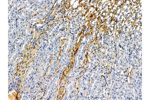 ABIN7095004 and ABIN7099060 at 1/100 staining mouse kidney tissue by IHC-P. (EFHA1 Antikörper)