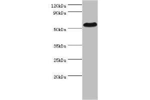 Western blot All lanes: PSEN1 antibody at 2 μg/mL + Hela whole cell lysate Secondary Goat polyclonal to rabbit IgG at 1/10000 dilution Predicted band size: 53, 43, 22, 47, 49 kDa Observed band size: 53 kDa (Presenilin 1 Antikörper  (AA 1-160))