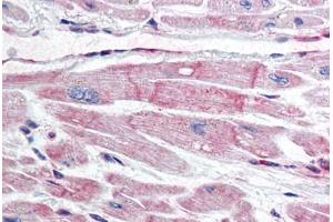 Human Heart (formalin-fixed, paraffin-embedded) stained with BIRC7 antibody ABIN298022 at 10 ug/ml followed by biotinylated anti-mouse IgG secondary antibody ABIN481714, alkaline phosphatase-streptavidin and chromogen. (BIRC7 Antikörper)