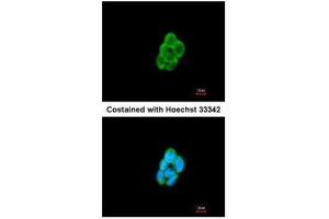 ICC/IF Image Immunofluorescence analysis of methanol-fixed A431, using CMTM6, antibody at 1:200 dilution. (CMTM6 Antikörper  (C-Term))